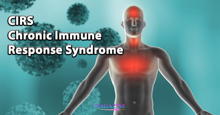 Chronic Immune Response Syndrome